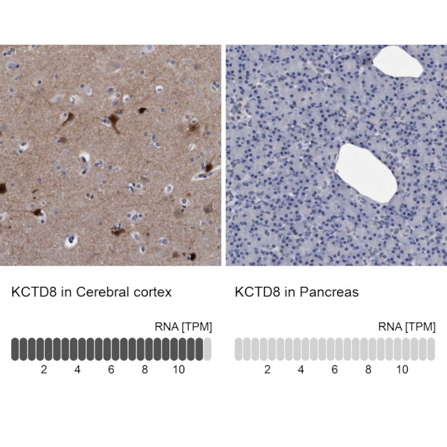 KCTD8 Antibody in Immunohistochemistry (IHC)