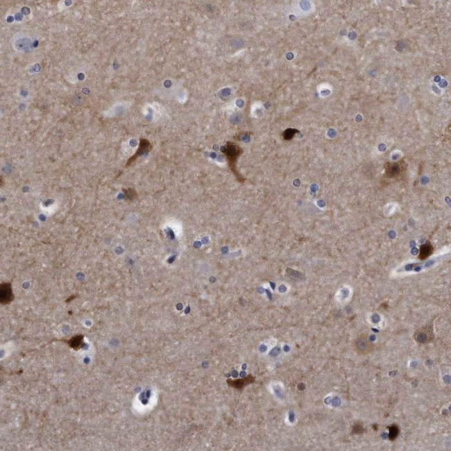 KCTD8 Antibody in Immunohistochemistry (IHC)