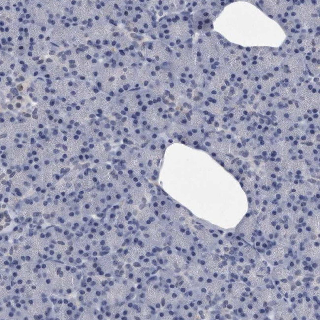 KCTD8 Antibody in Immunohistochemistry (IHC)