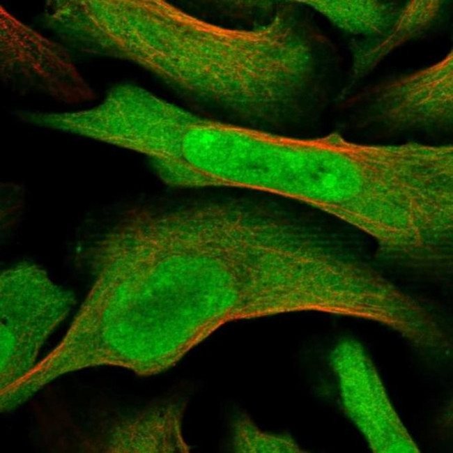 MAGED2 Antibody in Immunocytochemistry (ICC/IF)