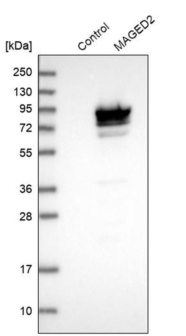 MAGED2 Antibody in Western Blot (WB)