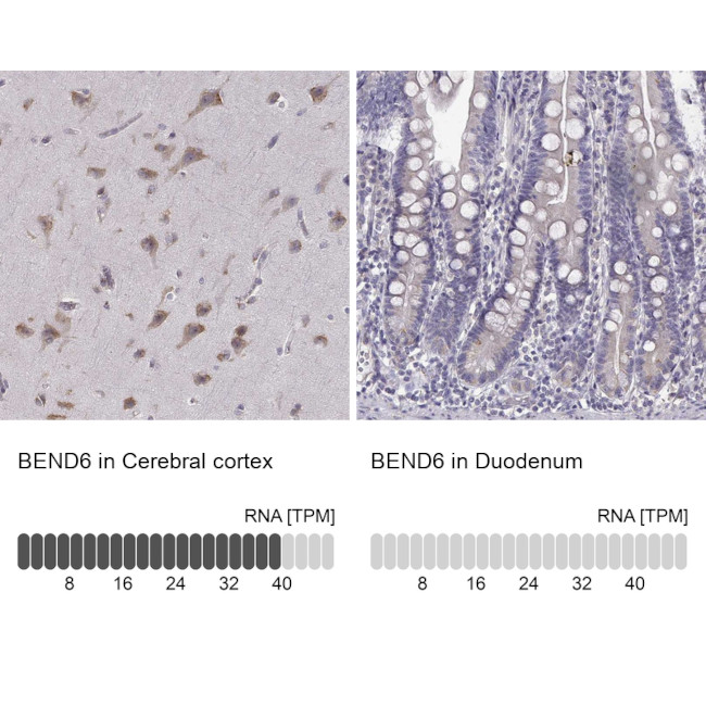 BEND6 Antibody in Immunohistochemistry (IHC)