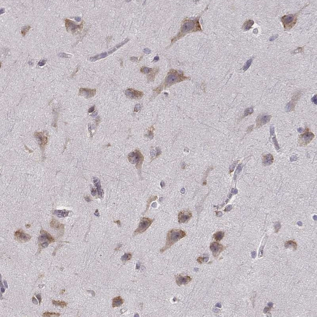 BEND6 Antibody in Immunohistochemistry (IHC)