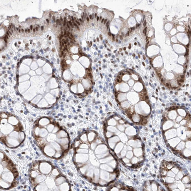 Atrophin 1 Antibody in Immunohistochemistry (IHC)