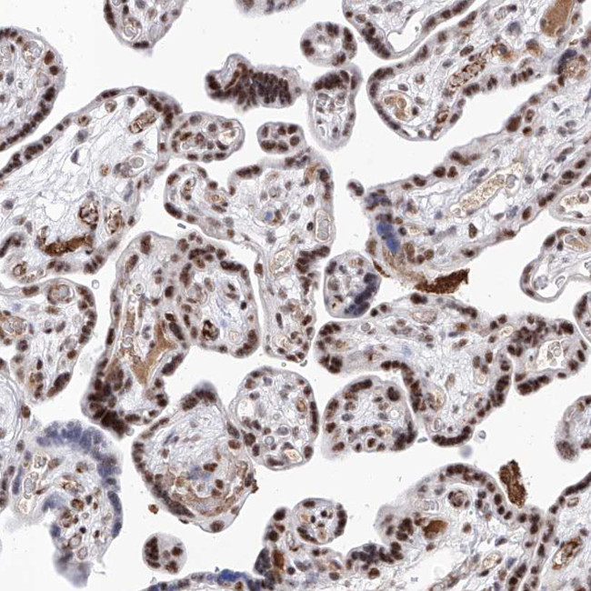 Atrophin 1 Antibody in Immunohistochemistry (IHC)