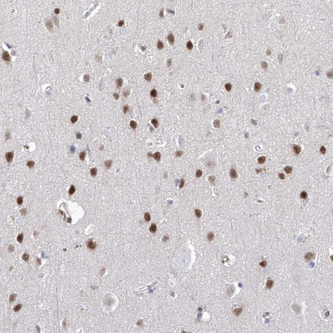 Atrophin 1 Antibody in Immunohistochemistry (IHC)