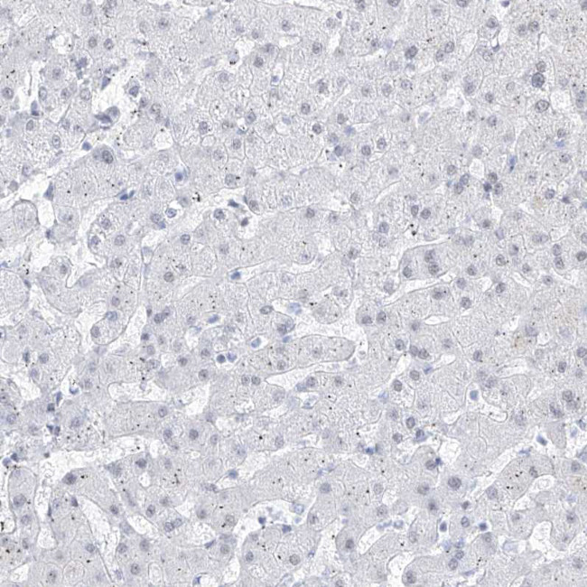 Atrophin 1 Antibody in Immunohistochemistry (IHC)