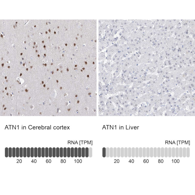 Atrophin 1 Antibody