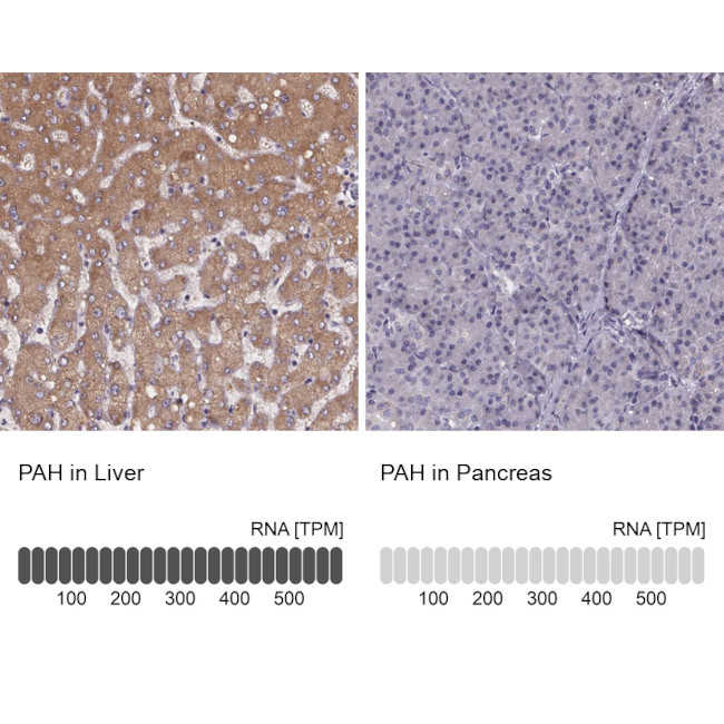 PAH Antibody in Immunohistochemistry (IHC)