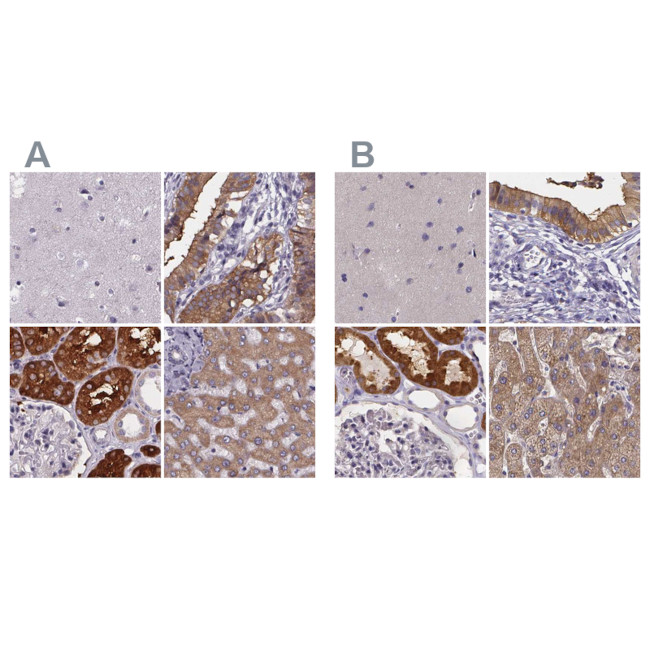 PAH Antibody in Immunohistochemistry (IHC)