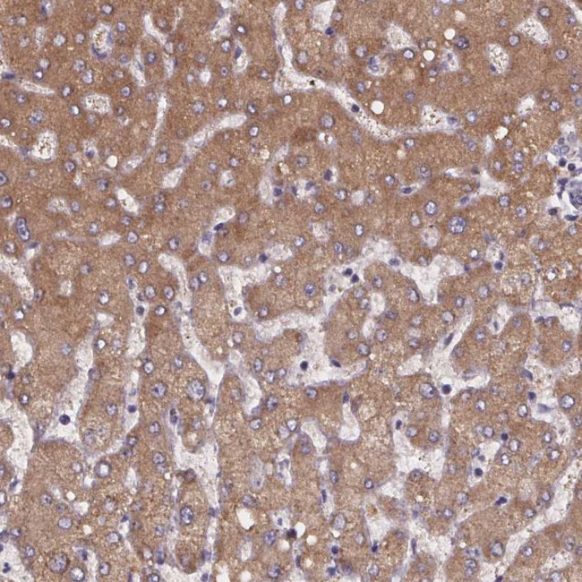 PAH Antibody in Immunohistochemistry (IHC)