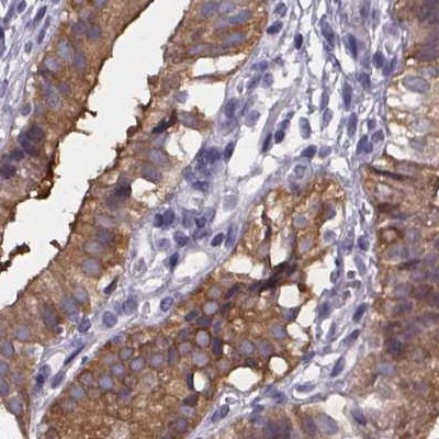 PAH Antibody in Immunohistochemistry (IHC)