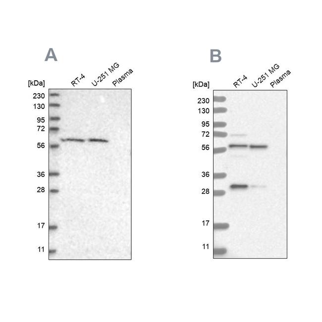 PAH Antibody in Western Blot (WB)