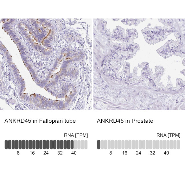 ANKRD45 Antibody