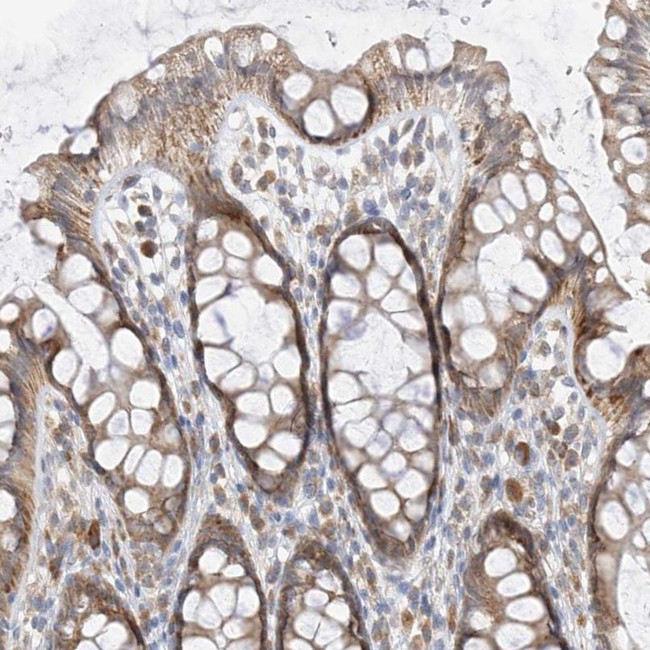 PPA2 Antibody in Immunohistochemistry (IHC)