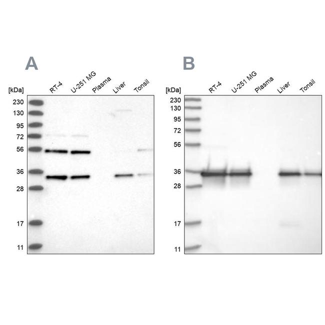 PPA2 Antibody in Western Blot (WB)