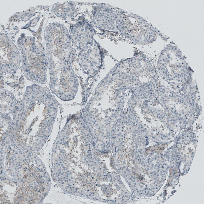 RSPH9 Antibody in Immunohistochemistry (IHC)