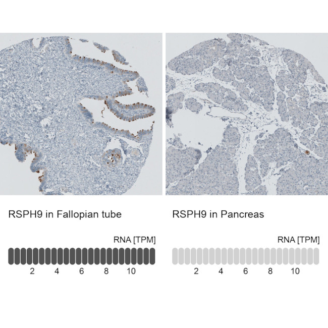 RSPH9 Antibody