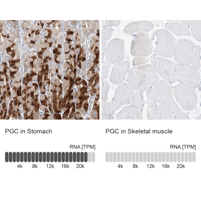 PGC Antibody in Immunohistochemistry (IHC)