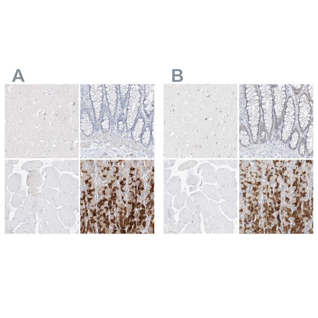 PGC Antibody in Immunohistochemistry (IHC)