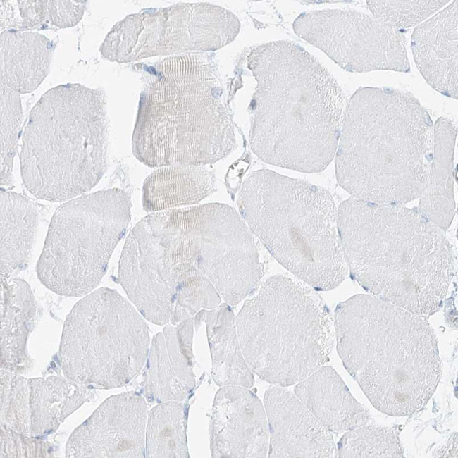 PGC Antibody in Immunohistochemistry (IHC)