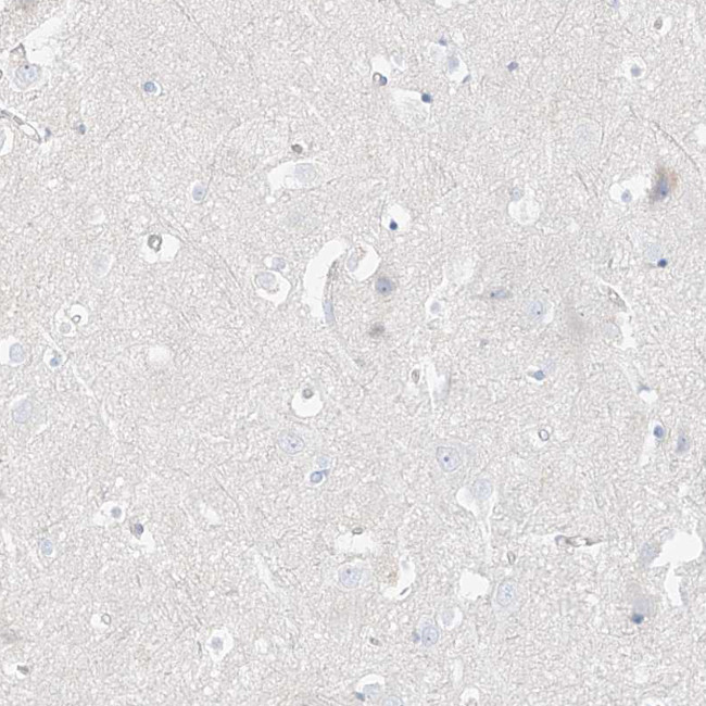 PGC Antibody in Immunohistochemistry (IHC)