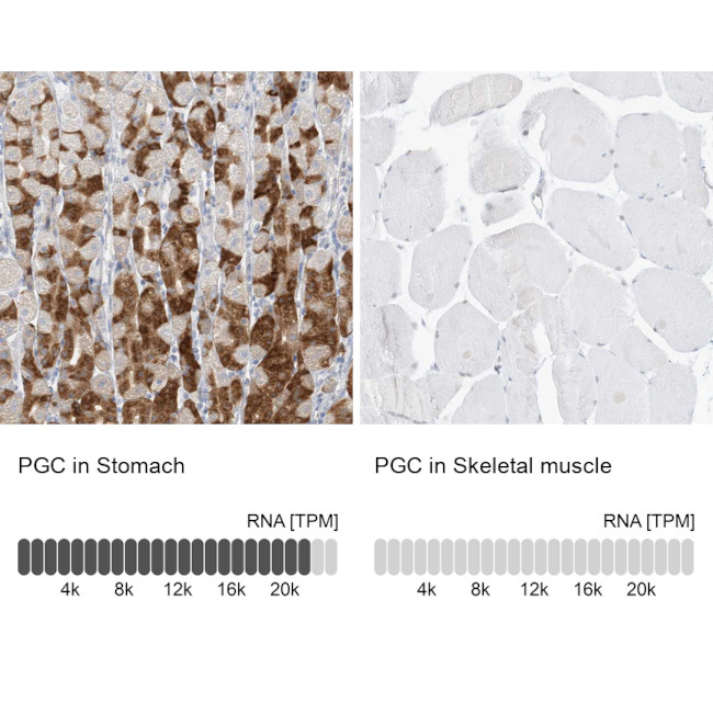 PGC Antibody in Immunohistochemistry (IHC)