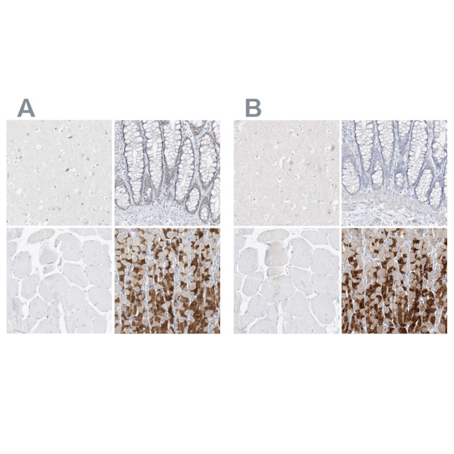 PGC Antibody in Immunohistochemistry (IHC)