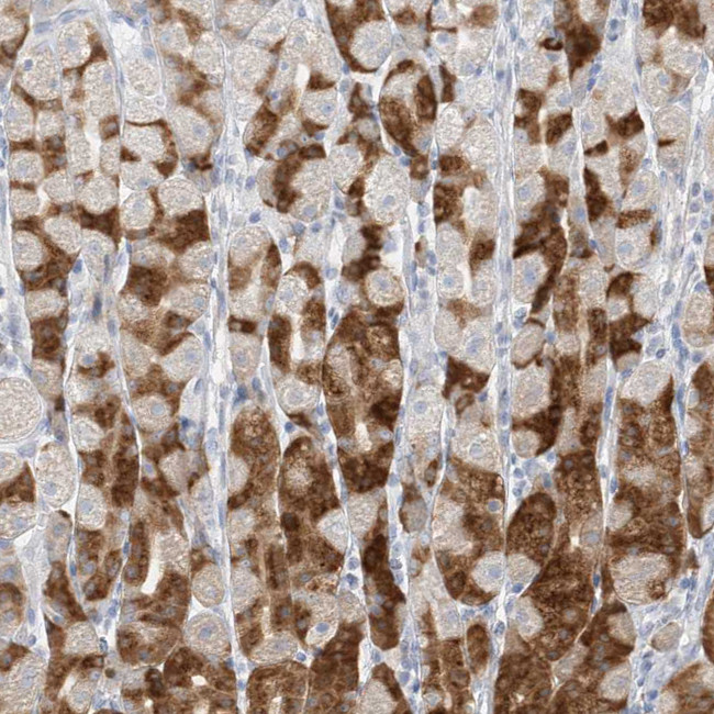 PGC Antibody in Immunohistochemistry (IHC)