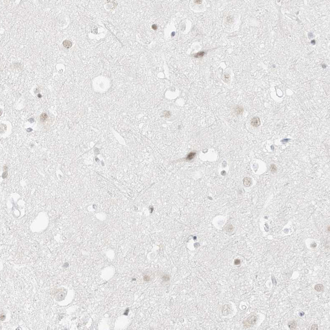 PGC Antibody in Immunohistochemistry (IHC)