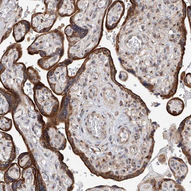 KIAA1919 Antibody in Immunohistochemistry (IHC)