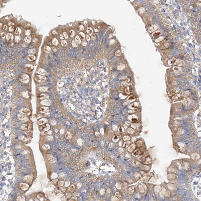 ZZEF1 Antibody in Immunohistochemistry (IHC)