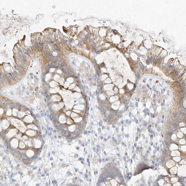 ZZEF1 Antibody in Immunohistochemistry (IHC)