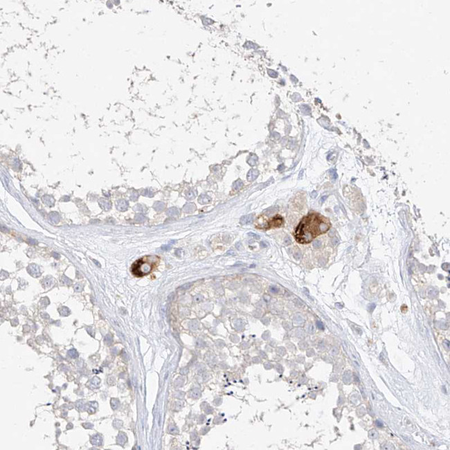 ZZEF1 Antibody in Immunohistochemistry (IHC)