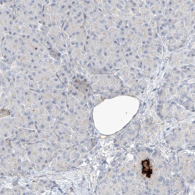 REEP2 Antibody in Immunohistochemistry (IHC)