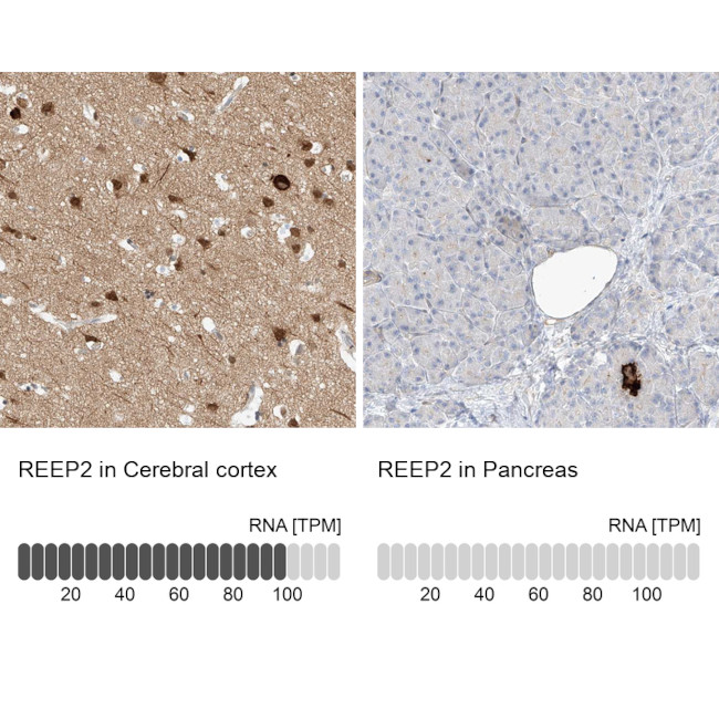 REEP2 Antibody