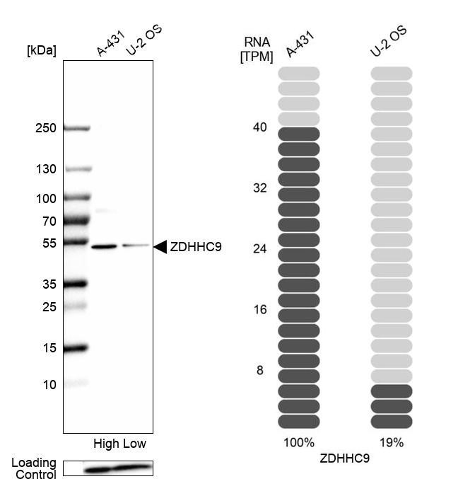 ZDHHC9 Antibody