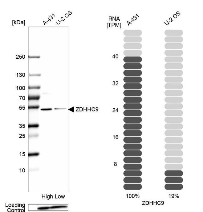 ZDHHC9 Antibody in Western Blot (WB)