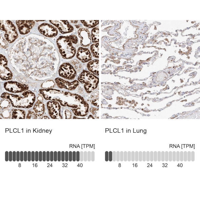 PLCL1 Antibody in Immunohistochemistry (IHC)