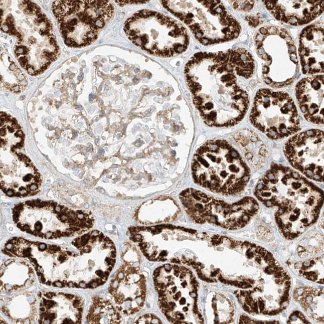 PLCL1 Antibody in Immunohistochemistry (IHC)