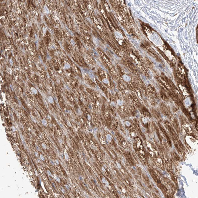 PLCL1 Antibody in Immunohistochemistry (IHC)