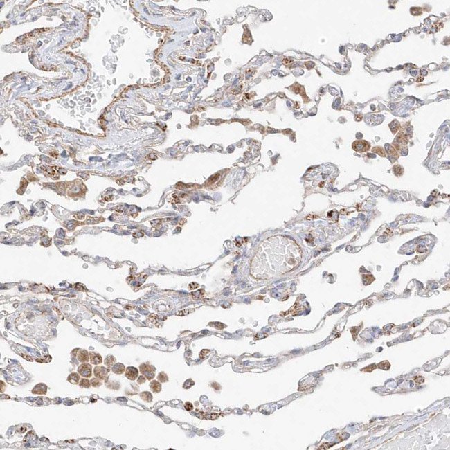 PLCL1 Antibody in Immunohistochemistry (IHC)