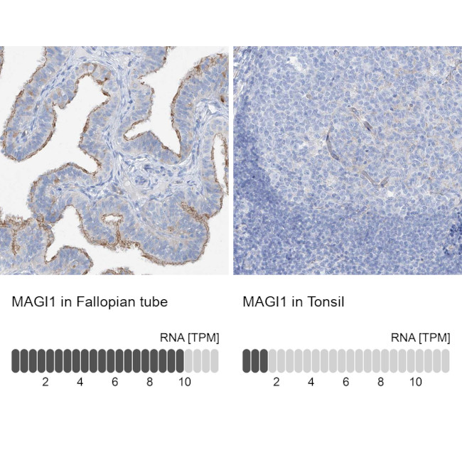 MAGI1 Antibody in Immunohistochemistry (IHC)