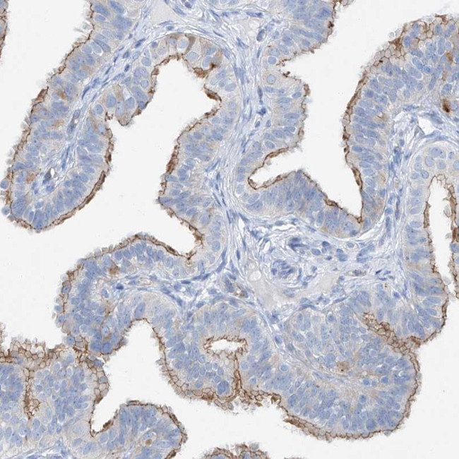 MAGI1 Antibody in Immunohistochemistry (IHC)