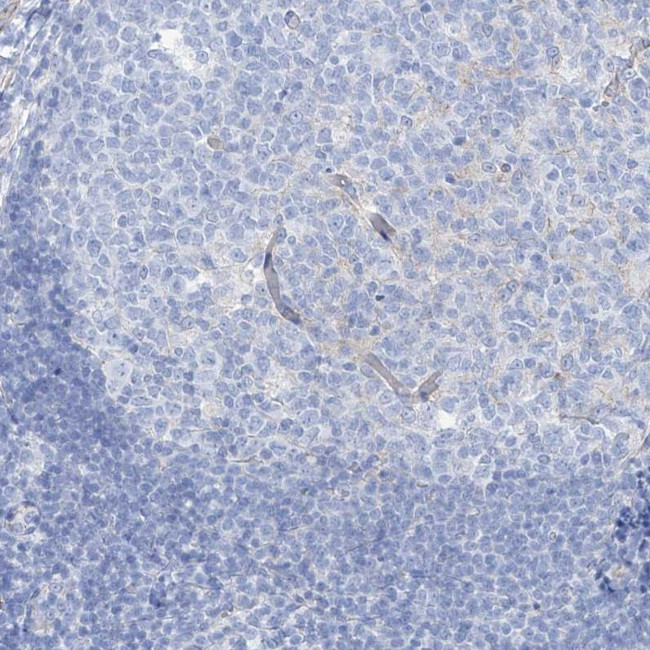 MAGI1 Antibody in Immunohistochemistry (IHC)