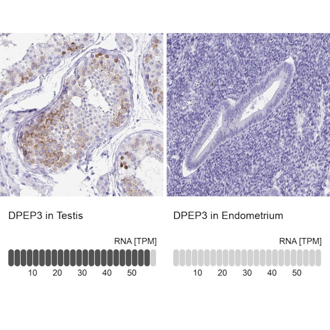 DPEP3 Antibody in Immunohistochemistry (IHC)