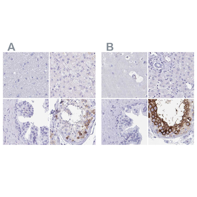 DPEP3 Antibody in Immunohistochemistry (IHC)