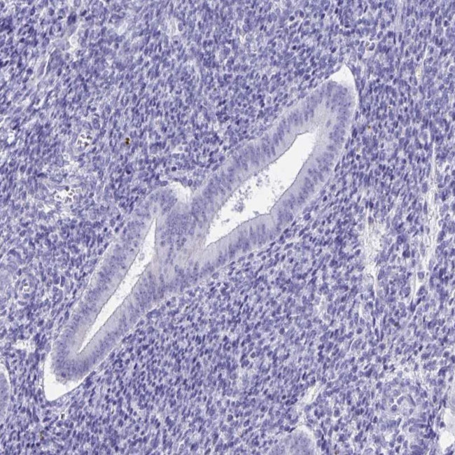 DPEP3 Antibody in Immunohistochemistry (IHC)