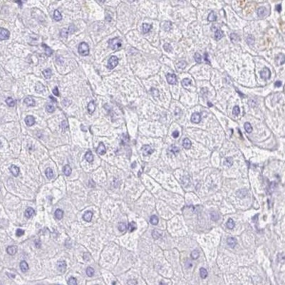 DPEP3 Antibody in Immunohistochemistry (IHC)