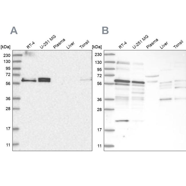 TSPYL1 Antibody in Western Blot (WB)